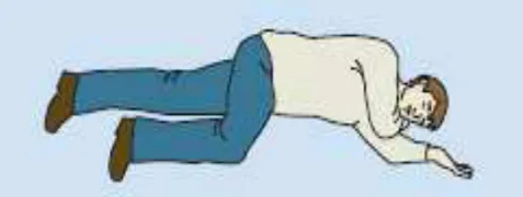 Fig. 14. Posición lateral de seguridad. 