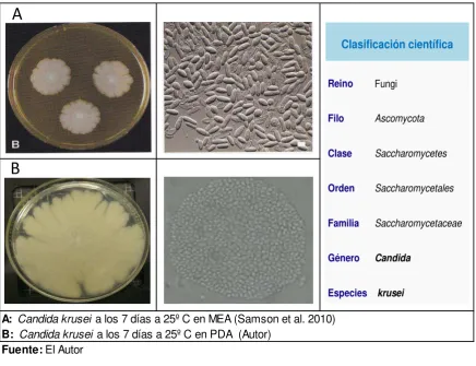 Figura 6 Características macroscópicas y microscópicas de Candida krusei