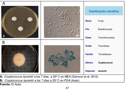 Figura 8  Características macroscópicas y microscópicas de Cryptococcus laurentii