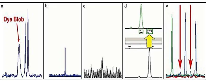 Figura 6. Artefactos de microsatélites a. Dye blob; b. Spike; c. Ruido; d. Pull-up; e