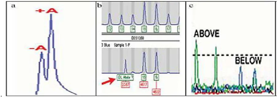 Figura 7. Artefactos de microsatélites a. Adenilación incompleta; b. escalera alélica; c.Degradación