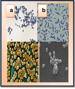 Fig. 11. Estructura morfológica de las bacterias gram-positivas  a) S.aureus b) E. Faecalis