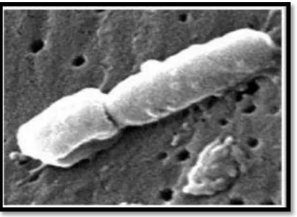 Figura 11: Samonella typhimurium Fuente: Brinkman, V et al. 2005  