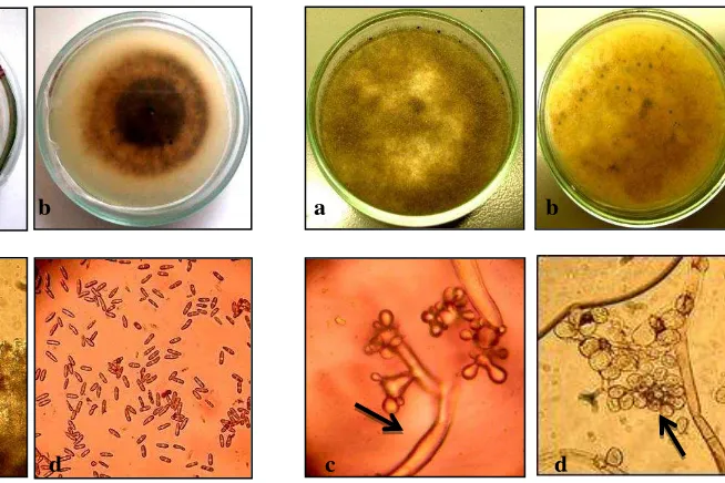 Fig. 2.  Morphologic  structure of  B. cinerea. a. Mycelium obverse b. Mycelium reverse c