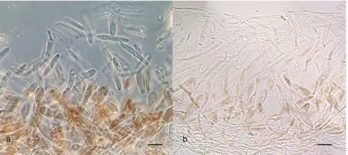 Figura  2.  Microfotografía  de  la  estructura  del  pileipellis  de  a)  Oudemansiella  platensis  (usando  contraste  de  fases), y de b) Oudemansiella aff