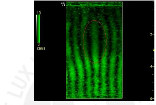 Figure 2.4: Crawling wave image of a gelatin phantom with a vibration frequency of 290Hz and 0.35 Hz oﬀset