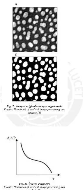 Fig. 2:  Imagen original e imagen segmentadaFuente: Handbook of medical image processing and