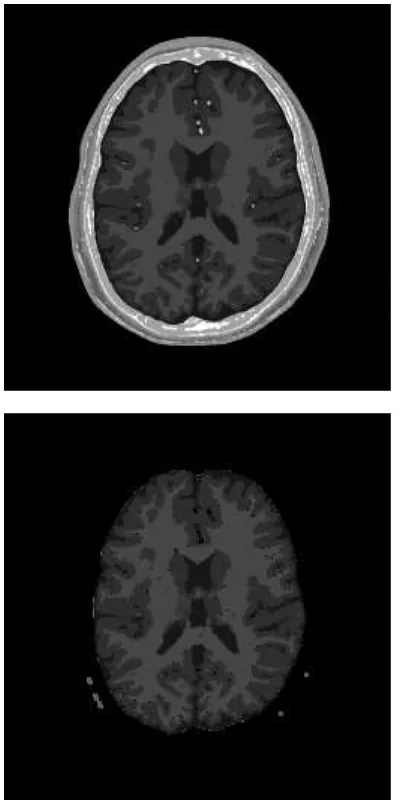 Fig. 8: Imagen original arriba, telencéfalo extraído en la parte inferiorFuente:  Elaboración propia