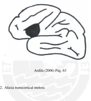 Figura 1: Área de la afasia de Broca 