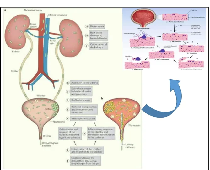 Figura 1 Fisiopatología de las infecciones de vías urinarias             Fuente: Paola Scavone; https://elblogdeliibce.wordpress.com 