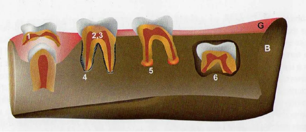 Figura 6. Ubicación de las células madre dentales adultas en los seres humanos. 