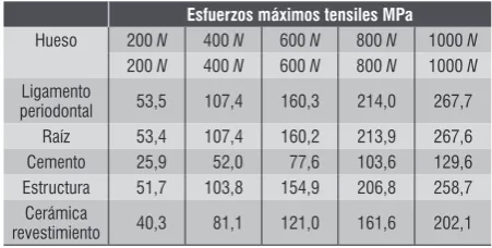 Table 13. Maximum tensile stresses (MPa) on a three-unit anterior 