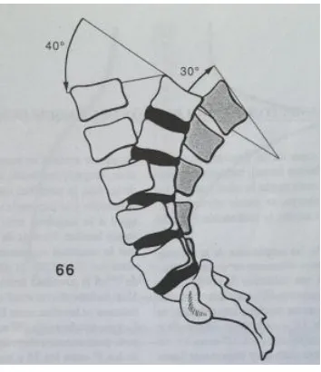 Fig. 11.- Amplitud de flexoextensión del raquis lumbar. 
