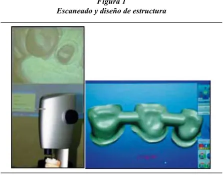 Figura 2