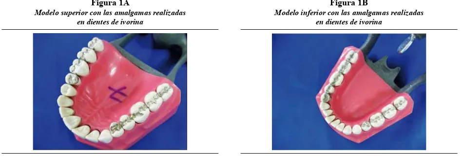 Figura 1A