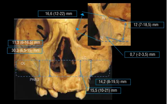 Figura 1