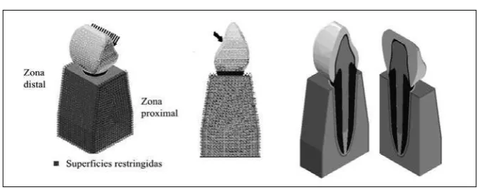 Figura 1