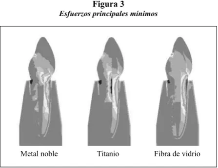 Figura 2