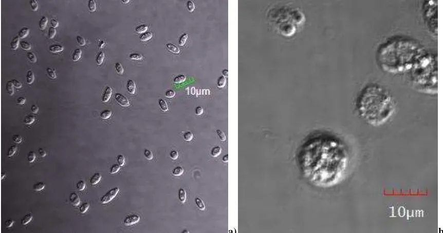 Figura 3. Observación de microconidias del hongo y de células de la hemolinfa. Aspecto de las microconidias del hongo y los hemocitos de larvas, antes de la infección: (a) microconidias de F