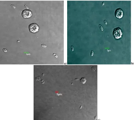 Figura 4. larvas infectadas con 10[um/Pixel], 60X O NA:1.42, colorante LCB; colorante RA; Granulocitos de G