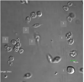 Figura 5. larvas infectadas con 10 Observación de diferentes tipos de hemocitos de G. mellonella