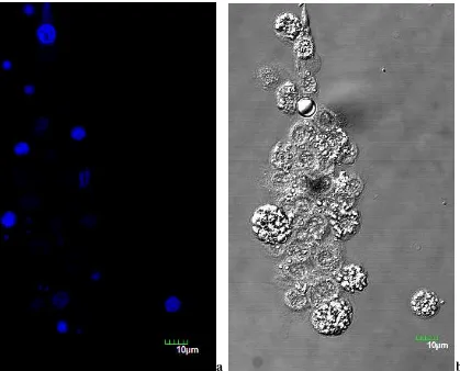 Figura 8. Células de larvas de G. mellonella. de granulocitos coloreados con Hoetch; (b) adipohemocitos y granulocitos por DIC (Nomarski) Aspecto de los hemocitos provenientes de la infección con 104microconidias/mL de F