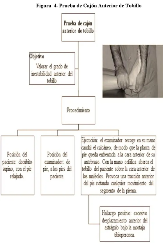 Figura  4. Prueba de Cajón Anterior de Tobillo 