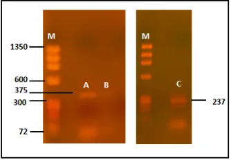 Figura 8. Electroforesis de los productos de PCR de ADNc y segunda cadena usando los cebadores F‐R (A,B) y  1‐4 (C). M corresponde al marcador molecular φX174 HaeIII GibCoBRL . 