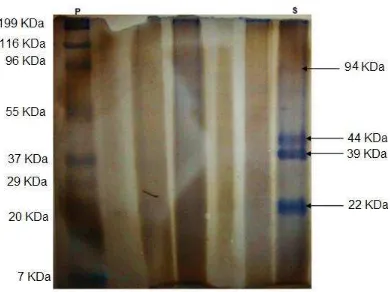 Figura 3: Perfil electroforético del extracto crudo de semillas precipitado con 