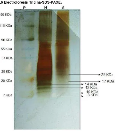 Figura 7: Perfil electroforético por el método Tricina-SDS-PAGE del extracto crudo de hojas y semillas, precipitado con sulfato de amonio al 70%