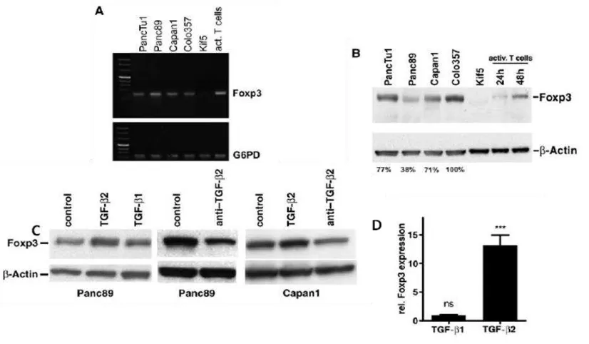 Figura 8 Expresión de Foxp3 en diferentes líneas celulares de cáncer de páncreas: detección de la expresión de FOXP3 en líneas celulares tratadas con TGF-de RNAm por RT-PCR (A) y detección de proteína por Western-Blot (B).Como control negativo para los dos