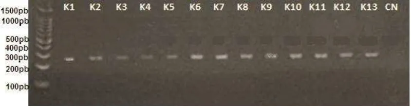 Figura 8: Electroforesis para productos de PCR del gen AXIN2 muestras de Cáncer (K1-K13) 