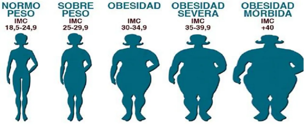 Figura 1 Clasificación de la obesidad