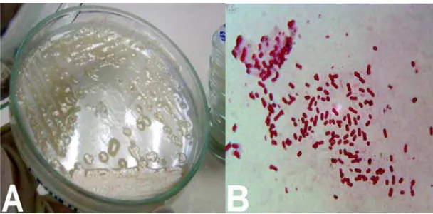 Figura 4. A) Colonias de Azotobacter spp. en medio libre de nitrógeno. B) Morfología de las células de Azotobacter spp
