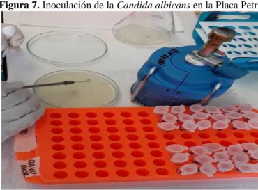 Figura 7. Inoculación de la Candida albicans en la Placa Petri 