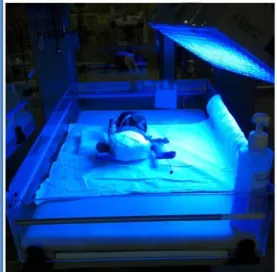 Figura 3 Fototerapia a recién nacido. 