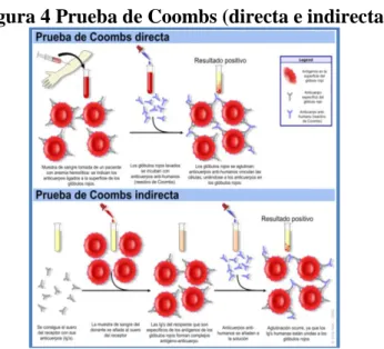 Figura 4 Prueba de Coombs (directa e indirecta) 