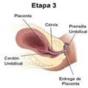 Fig. 4 Tercer periodo Alumbramiento  Tomado de www.medy-net.com   