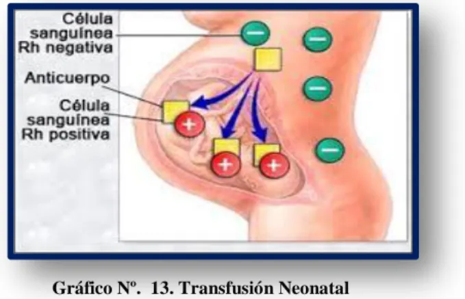 Gráfico Nº.  13. Transfusión Neonatal 