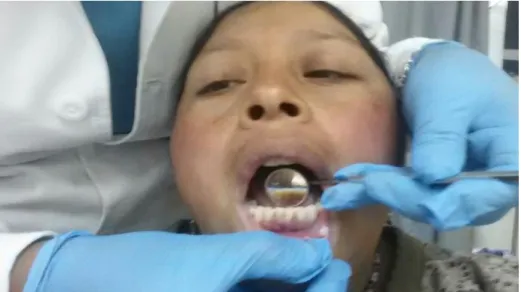 Fig. 12  Presencia de Calculo Dental 