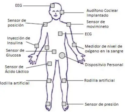 Figura 1.2. WBAN para monitoreo de pacientes[13]. 