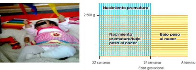 Figura  7.  El  nacimiento  prematuro.-  es  cuando  el  bebé  nace  antes  de  las  37  semanas  de  embarazo