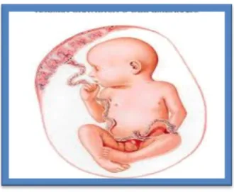 Figura N° 2.2. Esquema de Hemorragia Obstétricas. 