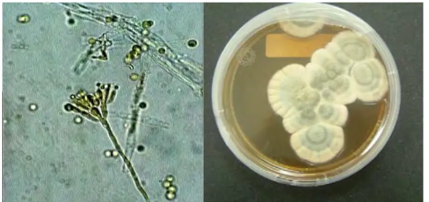 Figura 13.Modelo de la estructura  de un procarionte. Tomado  dehttp://www.educarchile.cl/Porta l.Base/Web/VerContenido.aspx?ID =133106  Figura12.Imagen de microscópica y macroscópica de Penicillumnotatum tomado  de  loshongosjrzs.blogspot.com 