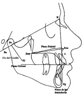 Fig. 9 Plano de Oclusión  Fuente: http://bruxistas.wordpress.com/tag/ejes-y-planos-de-ricketts/ 