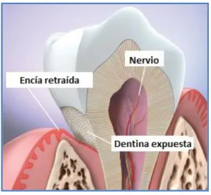 Figura Nº 6: Estructura Dentaria  