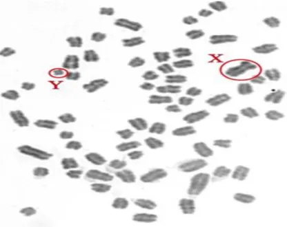 Ilustración 1: Metafase de leucocitos 2n=78, XY, Todos los autosomas acrocentricos y los  cromosomas sexuales metacéntricos de diferente tamaño (en círculos)