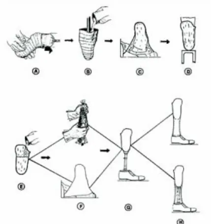 Figura 10. Socket pierna [12]. 