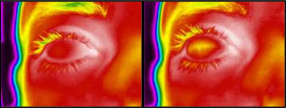 Figura 8 enfriamiento de la cornea en posición de fijación con parpadeo Fuente: Pruebas realizadas 