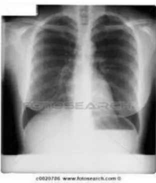 Ilustración 6. Ejemplo de imagen médica, radiografía. Tomada de Imágenes de Google. 